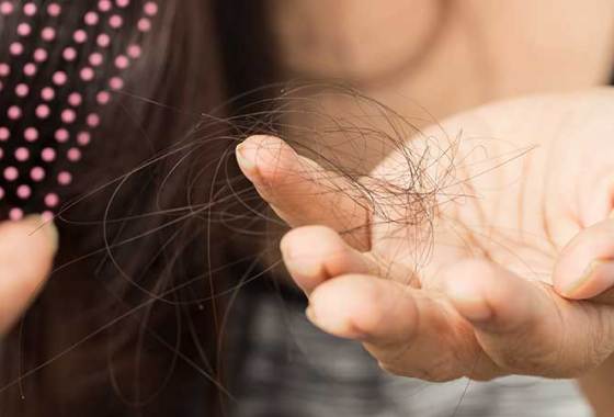 Best Hair Loss Treatments for Women